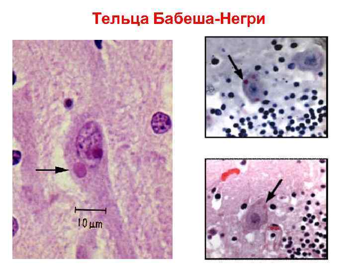 Вирус бешенства фото