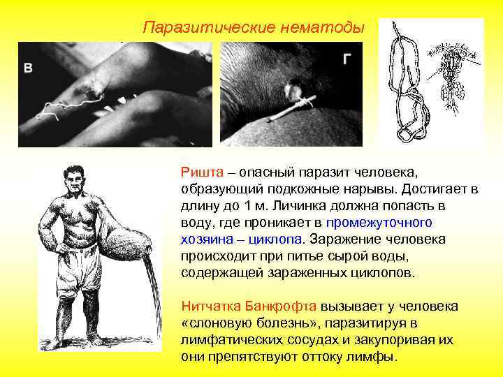 Паразитические нематоды Ришта – опасный паразит человека, образующий подкожные нарывы. Достигает в длину до