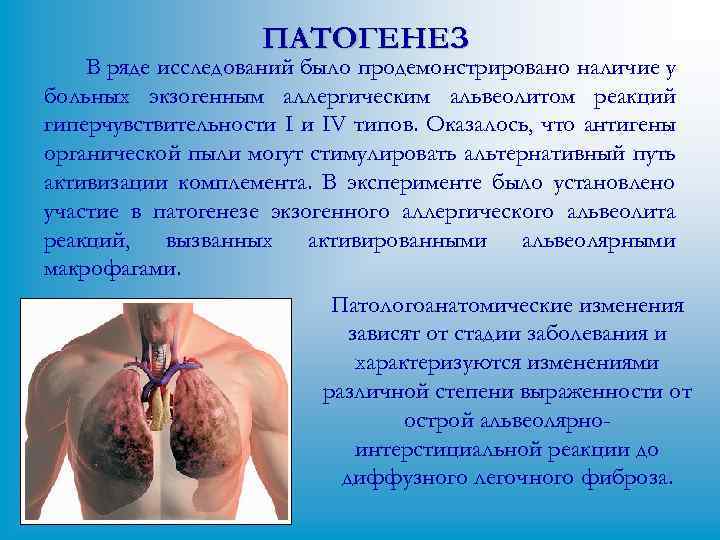 ПАТОГЕНЕЗ В ряде исследований было продемонстрировано наличие у больных экзогенным аллергическим альвеолитом реакций гиперчувствительности