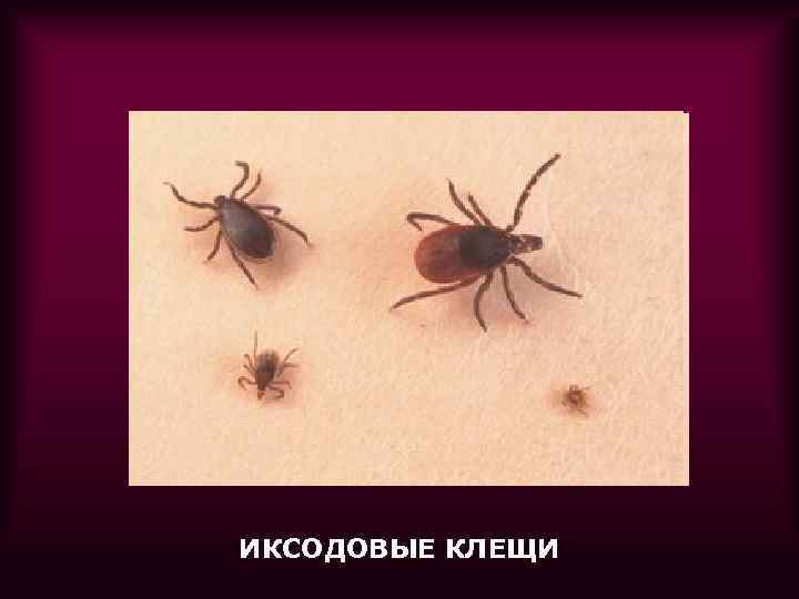 ИКСОДОВЫЕ КЛЕЩИ 