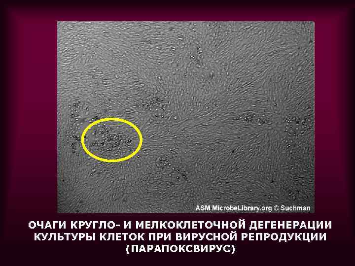 ОЧАГИ КРУГЛО- И МЕЛКОКЛЕТОЧНОЙ ДЕГЕНЕРАЦИИ КУЛЬТУРЫ КЛЕТОК ПРИ ВИРУСНОЙ РЕПРОДУКЦИИ (ПАРАПОКСВИРУС) 