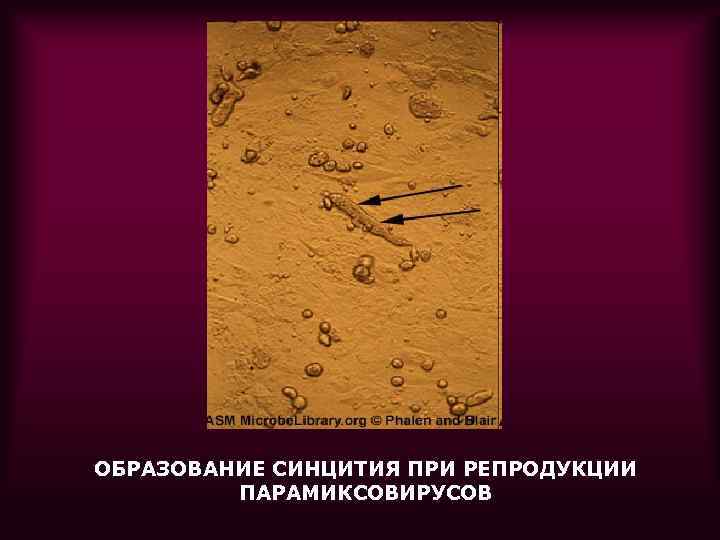 ОБРАЗОВАНИЕ СИНЦИТИЯ ПРИ РЕПРОДУКЦИИ ПАРАМИКСОВИРУСОВ 