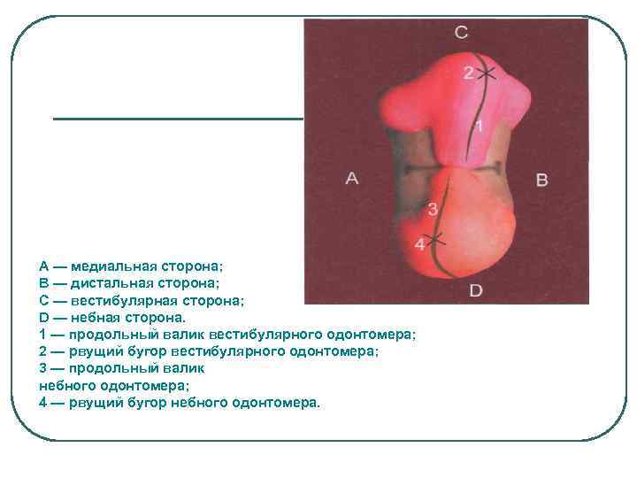 А — медиальная сторона; В — дистальная сторона; С — вестибулярная сторона; D —