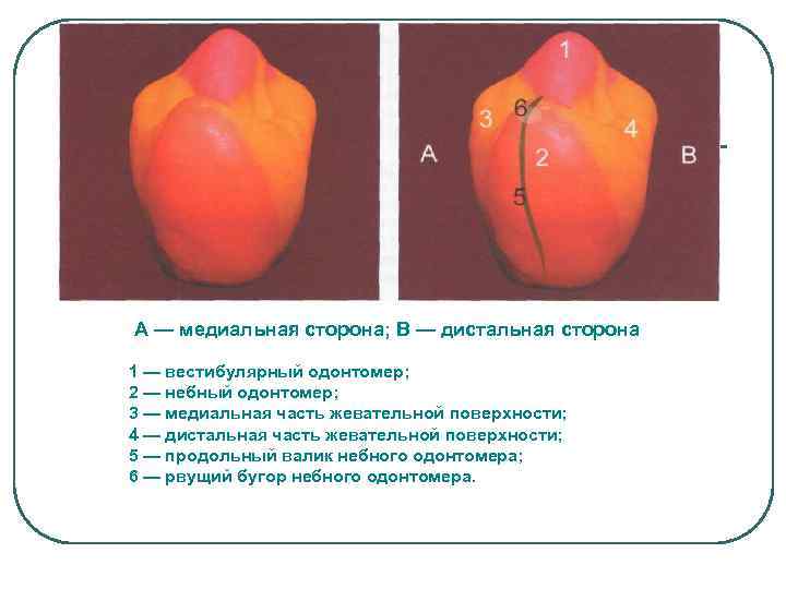 А — медиальная сторона; В — дистальная сторона 1 — вестибулярный одонтомер; 2 —