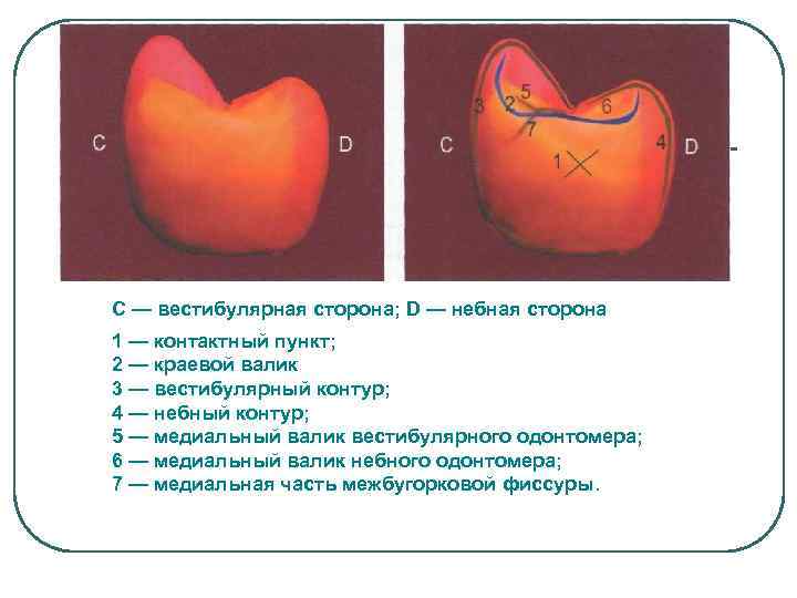 С — вестибулярная сторона; D — небная сторона 1 — контактный пункт; 2 —
