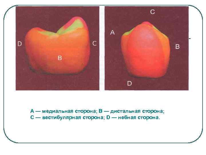 А — медиальная сторона; В — дистальная сторона; С — вестибулярная сторона; D —