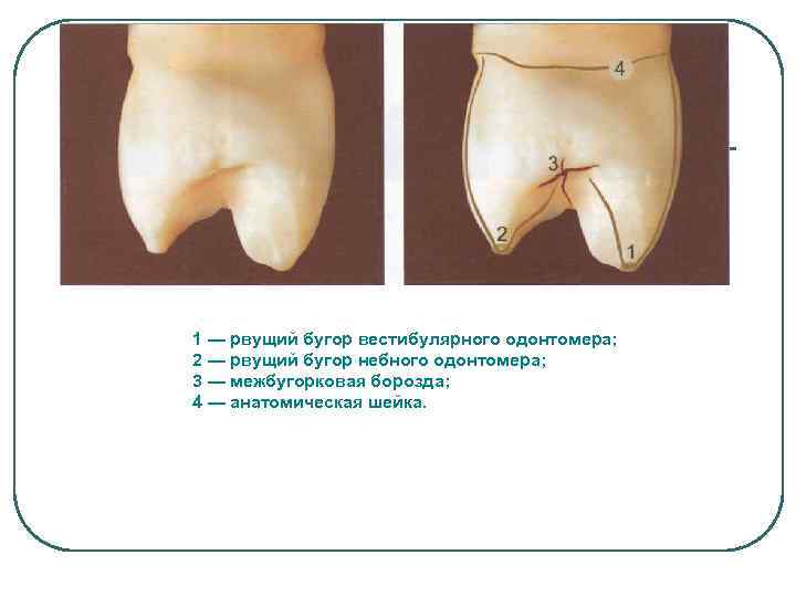 1 — рвущий бугор вестибулярного одонтомера; 2 — рвущий бугор небного одонтомера; 3 —