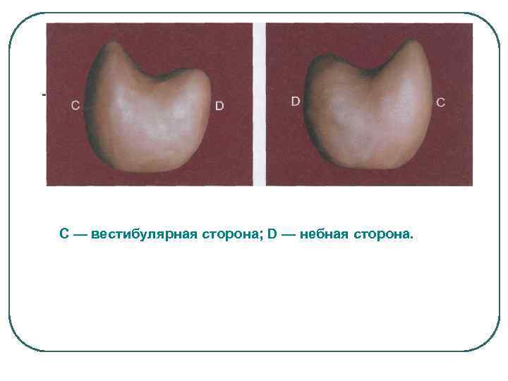 С — вестибулярная сторона; D — небная сторона. 