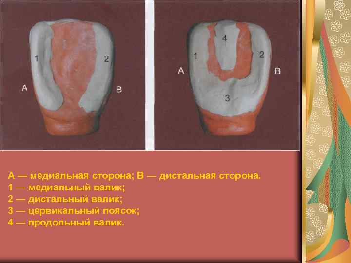 Стороны зуба. Медиальная и дистальная часть зуба. Медиальный и дистальный угол зуба. Медиальный и дистальный край коронки. Медиальный резец верхней челюсти стороны.