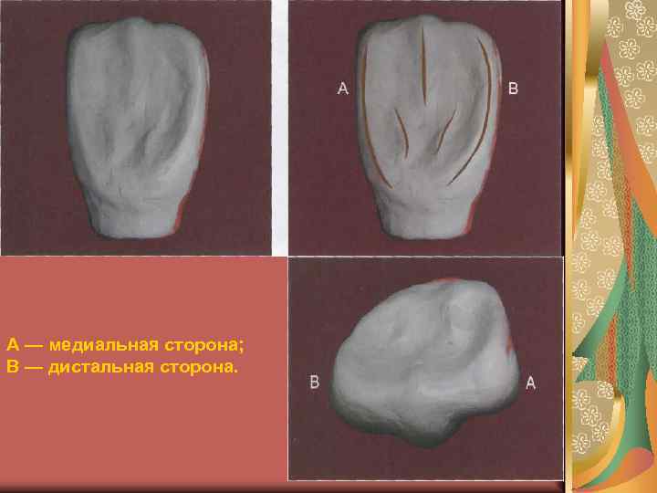 Боковой резец верхней челюсти фото