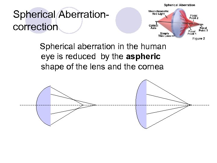 Spherical Aberration- correction Spherical aberration in the human eye is reduced by the aspheric