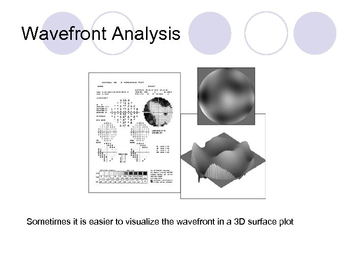 Wavefront Analysis Sometimes it is easier to visualize the wavefront in a 3 D