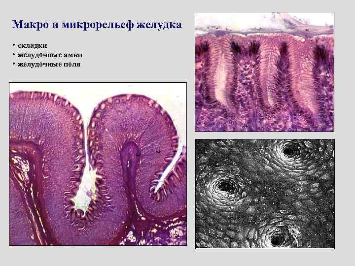 Складки слизистой. Складки желудка гистология. Желудочные ямочки гистология. Желудочные складки гистология. Желудочные ямки гистология.