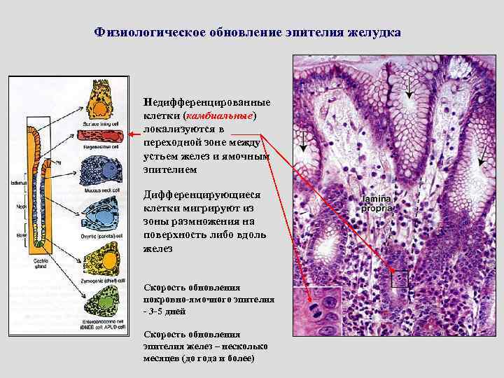 Физиологическое обновление эпителия желудка Недифференцированные клетки (камбиальные) локализуются в переходной зоне между устьем желез