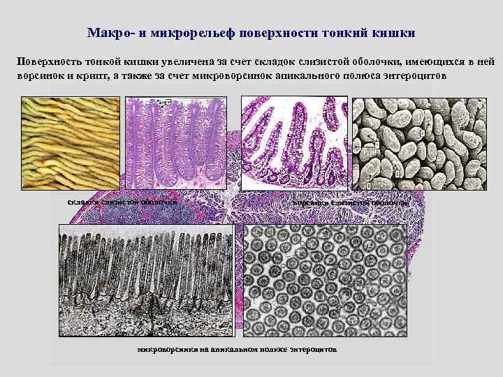 Макро- и микрорельеф поверхности тонкий кишки Поверхность тонкой кишки увеличена за счет складок слизистой