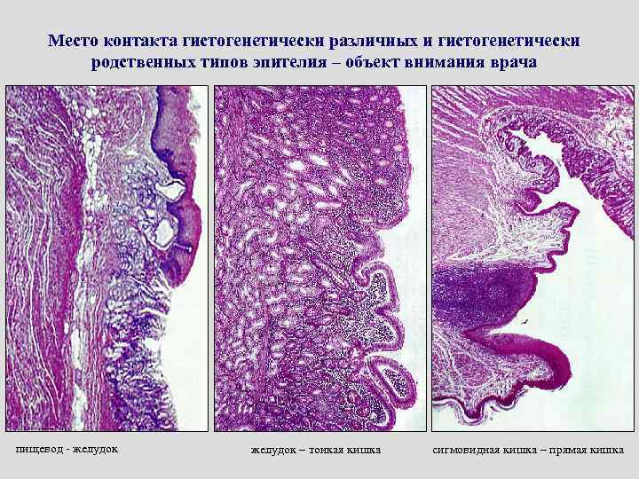 Место контакта гистогенетически различных и гистогенетически родственных типов эпителия – объект внимания врача пищевод
