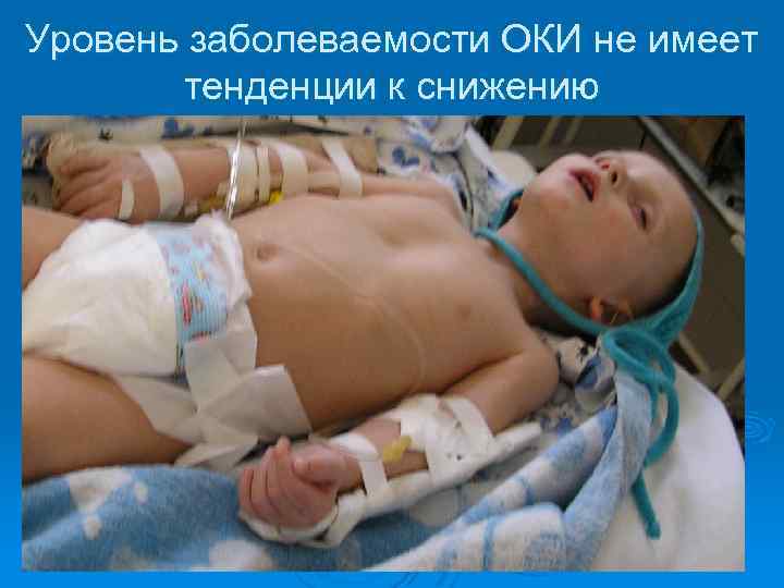 Уровень заболеваемости ОКИ не имеет тенденции к снижению 