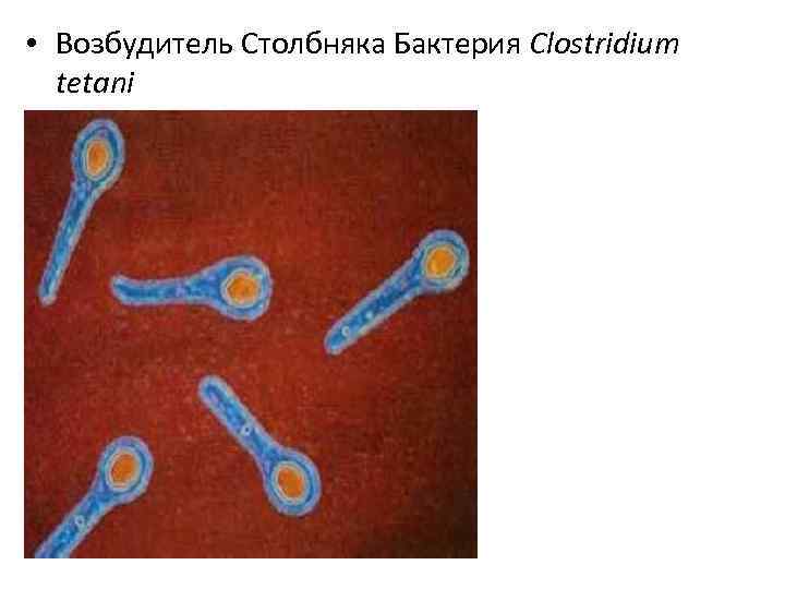 Столбняк эпидемиология. Возбудитель столбняка Clostridium tetani это. Столбнячная палочка бактерия. Столбнячная палочка Clostridium tetani. Столбнячная палочка схемы.
