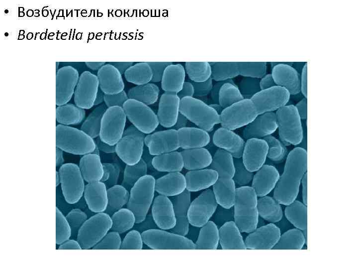 Бордетелла пертусис. Бордетеллы коклюша. Бордетелла пертуссис. Бактерия Bordetella pertussis. Бордетеллы коклюша микроскопия.