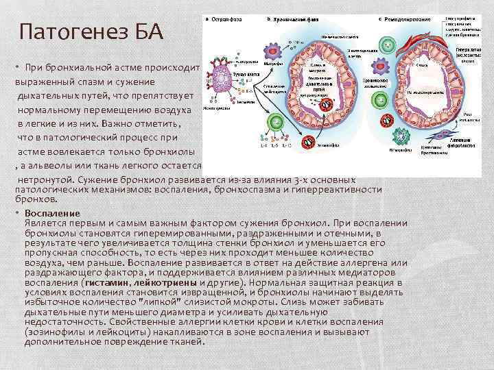 Патогенез БА • При бронхиальной астме происходит выраженный спазм и сужение дыхательных путей, что