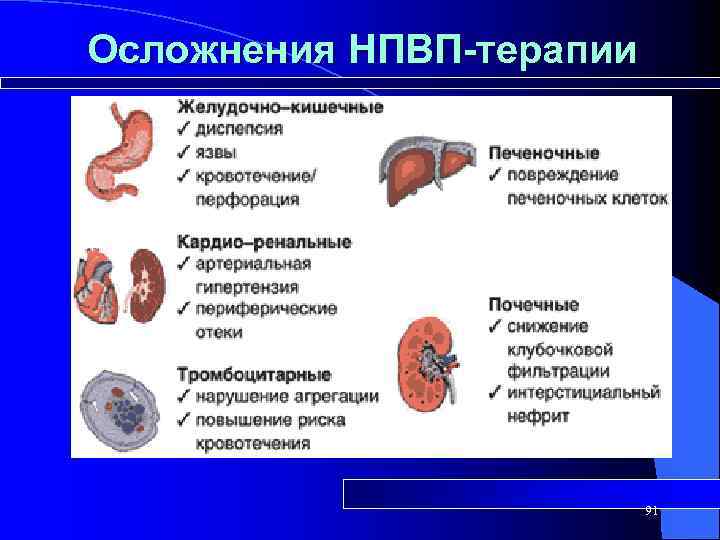 Осложнения НПВП-терапии 91 