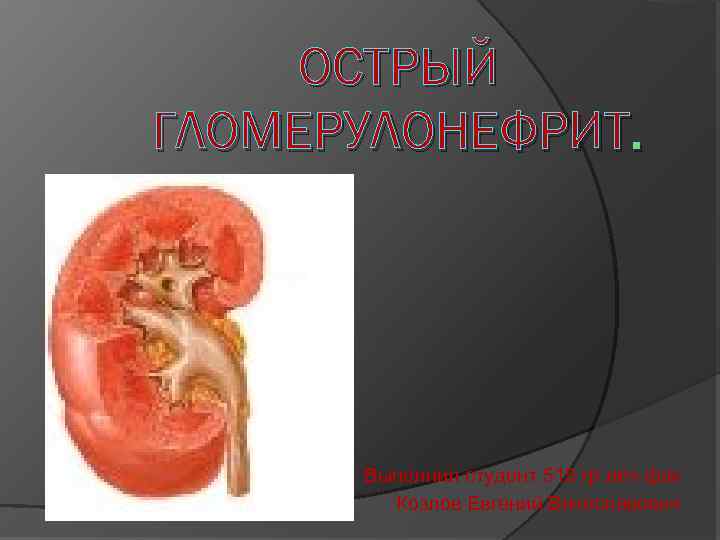 ОСТРЫЙ ГЛОМЕРУЛОНЕФРИТ. Выполнил студент 515 гр леч фак Козлов Евгений Вячеславович 