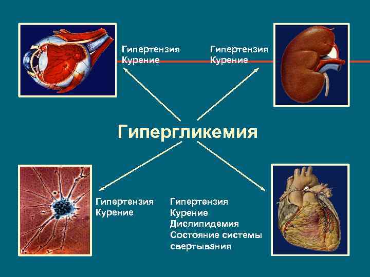 Гипертензия Курение Гипергликемия Гипертензия Курение Дислипидемия Состояние системы свертывания 