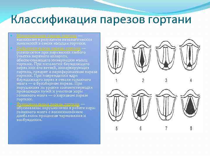Классификация парезов гортани Миопатические парезы гортани — возникают в результате патологических изменений в самих