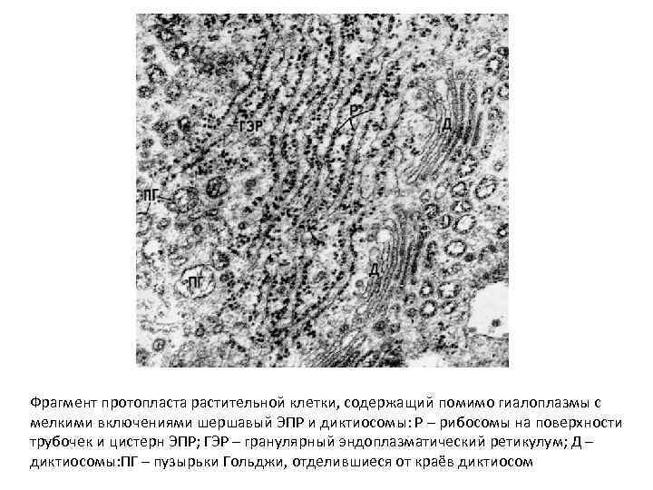 Фрагмент протопласта растительной клетки, содержащий помимо гиалоплазмы с мелкими включениями шершавый ЭПР и диктиосомы: