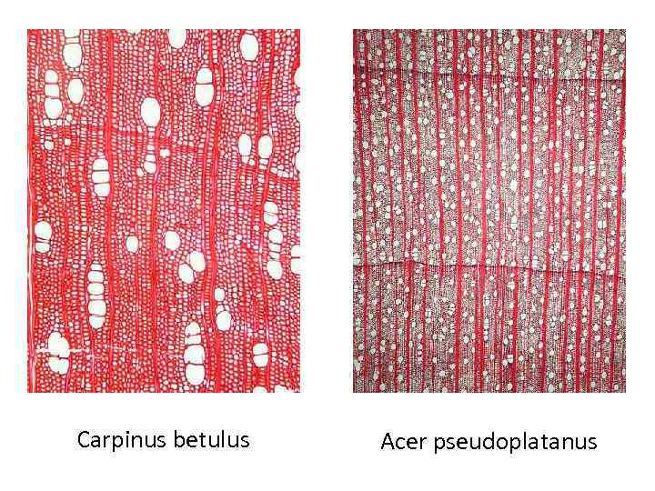 Carpinus betulus Acer pseudoplatanus 