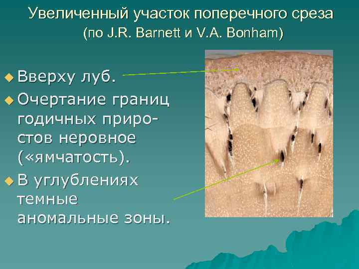 Увеличенный участок поперечного среза (по J. R. Barnett и V. A. Bonham) u Вверху