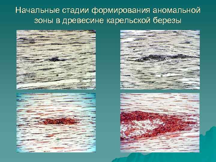 Начальные стадии формирования аномальной зоны в древесине карельской березы 