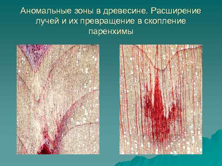 Аномальные зоны в древесине. Расширение лучей и их превращение в скопление паренхимы 