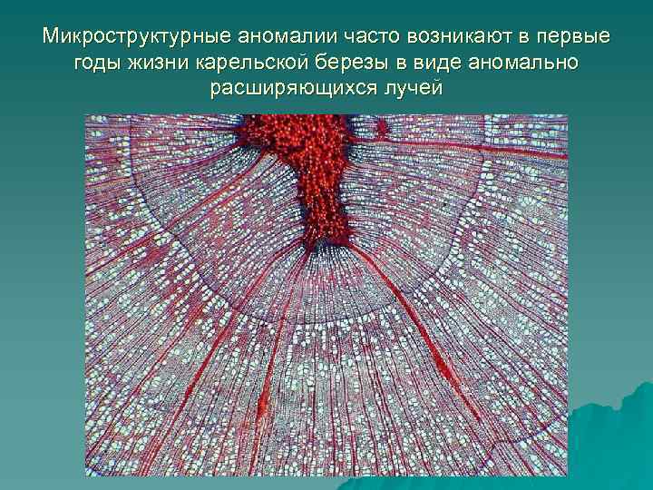Микроструктурные аномалии часто возникают в первые годы жизни карельской березы в виде аномально расширяющихся
