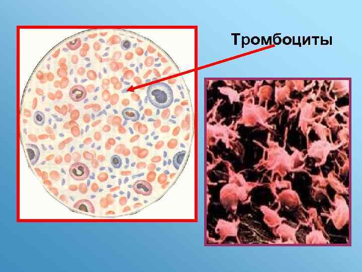 Тромбоциты 