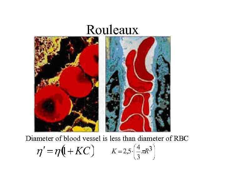 Rouleaux Diameter of blood vessel is less than diameter of RBC 