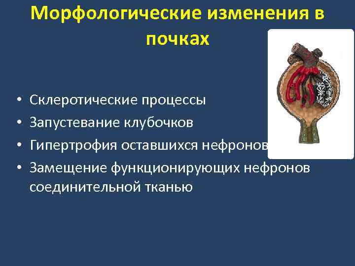 Морфологические изменения в почках • • Склеротические процессы Запустевание клубочков Гипертрофия оставшихся нефронов Замещение