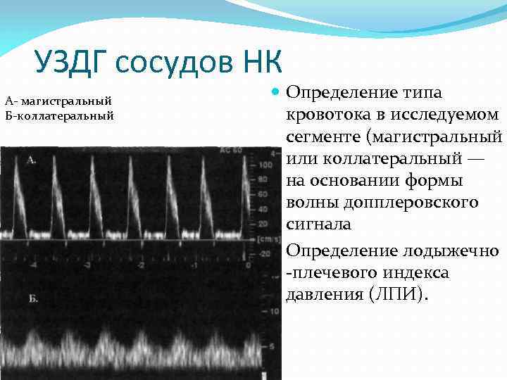 УЗДГ сосудов НК А- магистральный Б-коллатеральный Определение типа кровотока в исследуемом сегменте (магистральный или