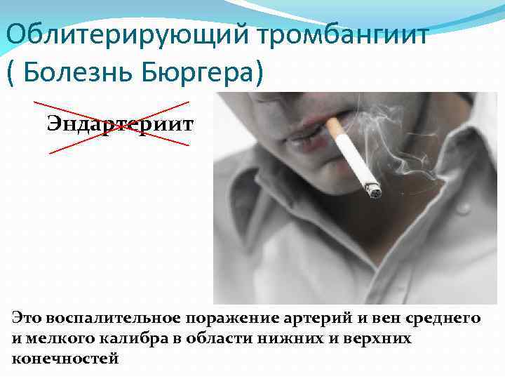 Облитерирующий тромбангиит ( Болезнь Бюргера) Эндартериит Это воспалительное поражение артерий и вен среднего и