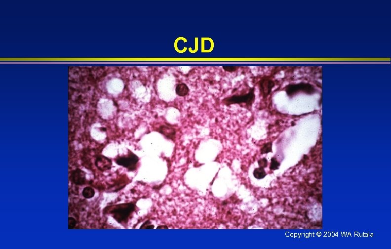 CJD Copyright © 2004 WA Rutala 