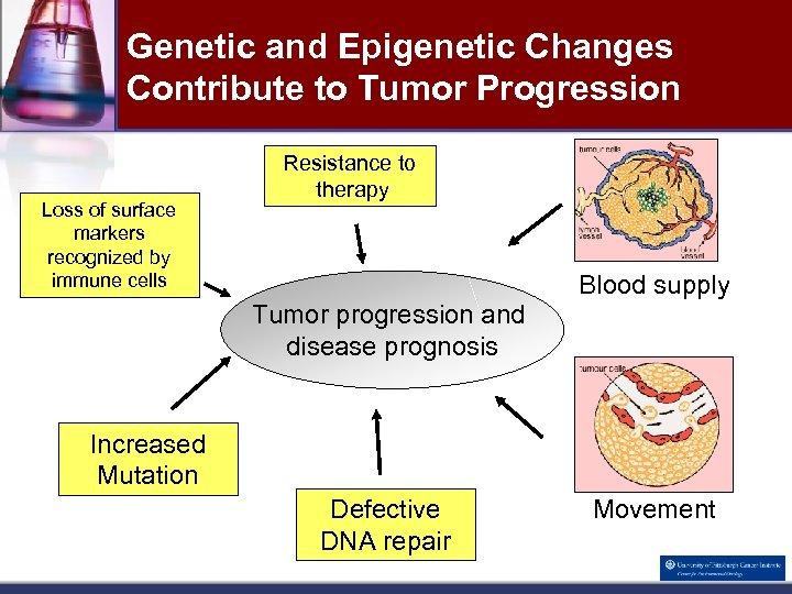 Genetic and Epigenetic Changes Contribute to Tumor Progression Loss of surface markers recognized by