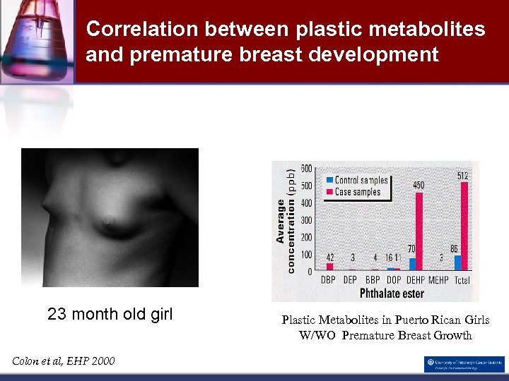 Correlation between plastic metabolites and premature breast development 23 month old girl Colon et