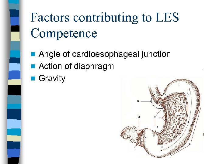 Factors contributing to LES Competence Angle of cardioesophageal junction n Action of diaphragm n