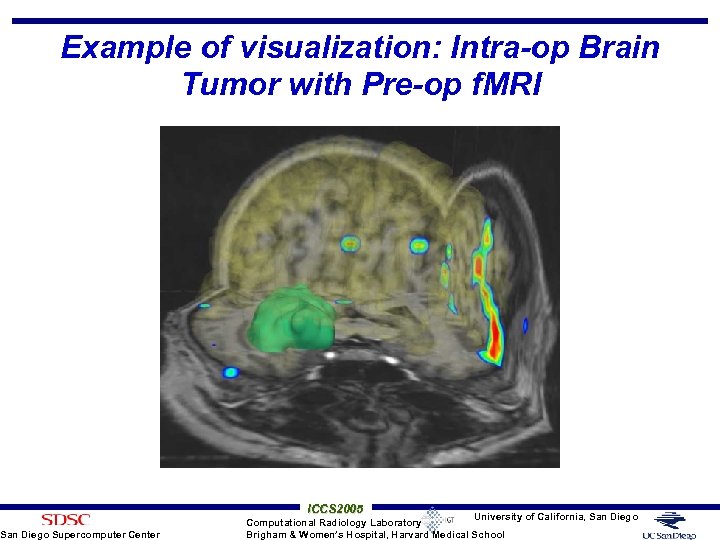 Example of visualization: Intra-op Brain Tumor with Pre-op f. MRI San Diego Supercomputer Center