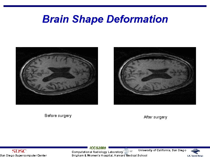 Brain Shape Deformation Before surgery San Diego Supercomputer Center After surgery ICCS 2005 University