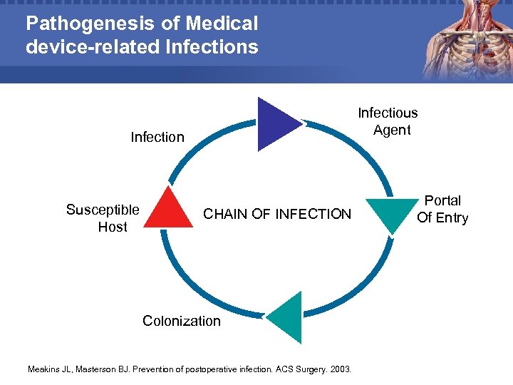 Pathogenesis of Medical device-related Infections Infectious Agent Infection Susceptible Host CHAIN OF INFECTION Colonization