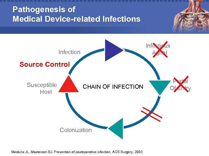 Pathogenesis of Medical Device-related Infections Infectious Agent Infection Source Control Susceptible Host CHAIN OF