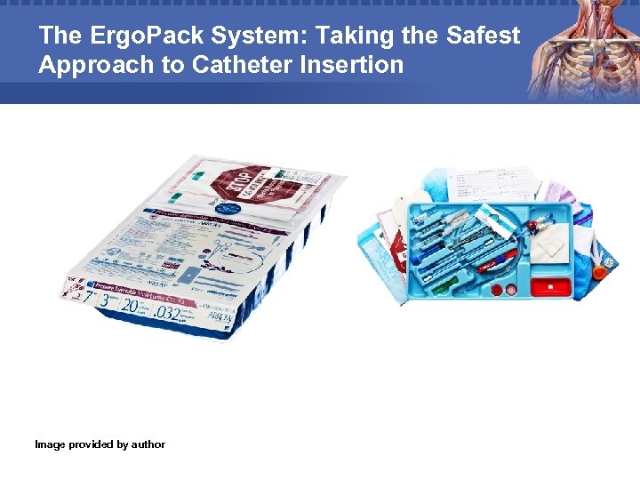 The Ergo. Pack System: Taking the Safest Approach to Catheter Insertion Image provided by