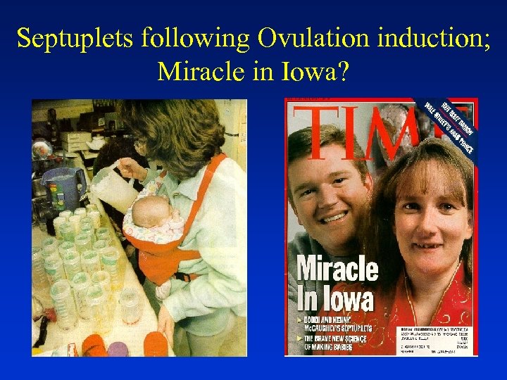 Septuplets following Ovulation induction; Miracle in Iowa? 