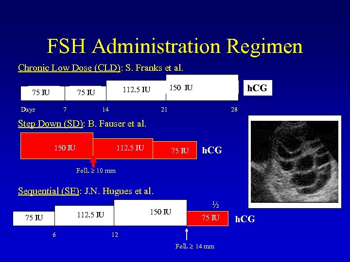 FSH Administration Regimen Chronic Low Dose (CLD): S. Franks et al. 75 IU Days